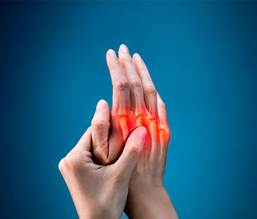Arthritis Treatments